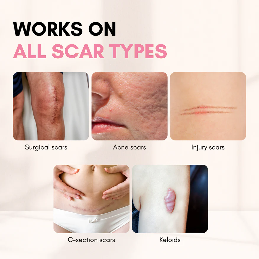 Bleava Scar Removal Stick