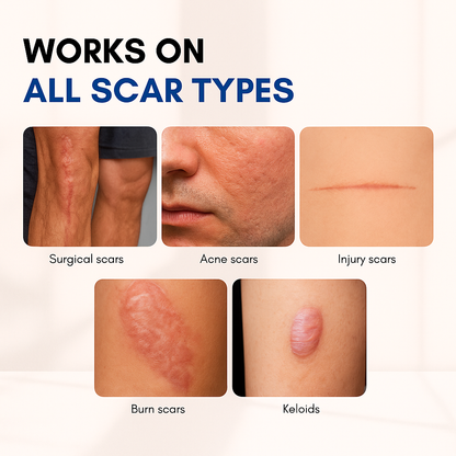 Bleava Scar Solutions Stick